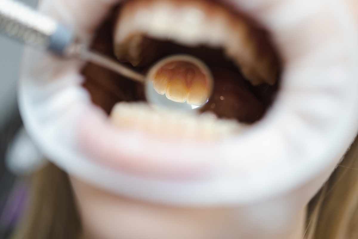 Hermitage Dentist