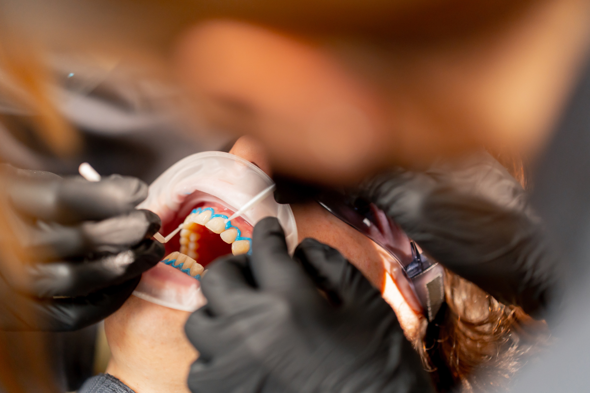 Cosmetic Dentistry Treatment