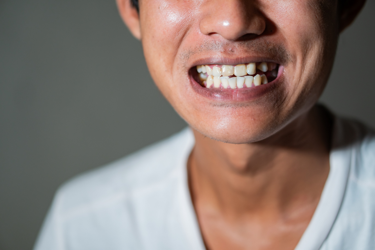 cosmetic dentistry in Hermitage